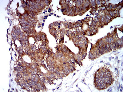 TRIM25 Antibody in Immunohistochemistry (Paraffin) (IHC (P))