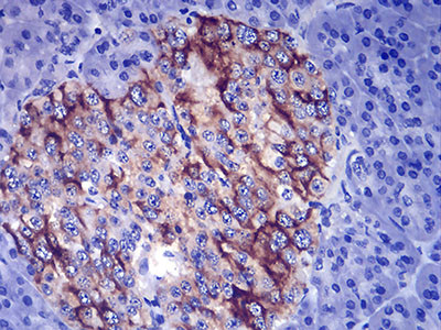 TSH beta Antibody in Immunohistochemistry (Paraffin) (IHC (P))