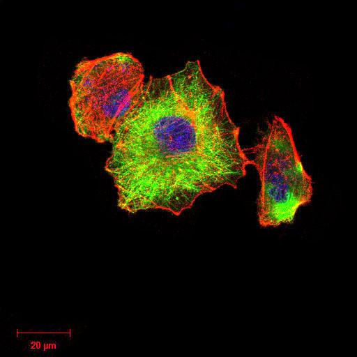 TUBB1 Antibody in Immunocytochemistry (ICC/IF)