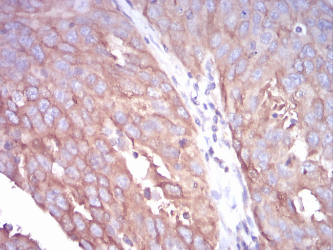 TUBB1 Antibody in Immunohistochemistry (Paraffin) (IHC (P))