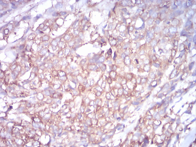 TUBB1 Antibody in Immunohistochemistry (Paraffin) (IHC (P))