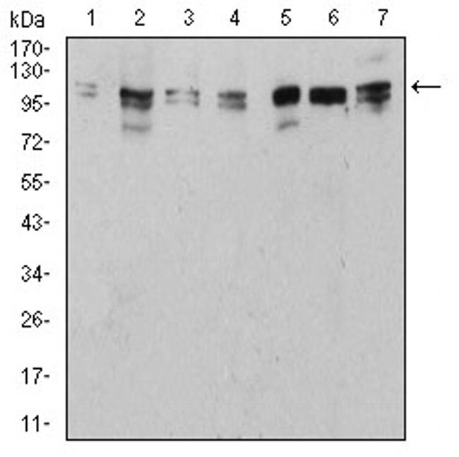 ULK2 Antibody in Western Blot (WB)