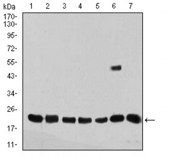 SELS Antibody in Western Blot (WB)