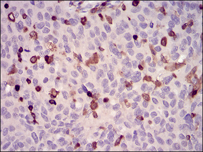 WASP Antibody in Immunohistochemistry (Paraffin) (IHC (P))