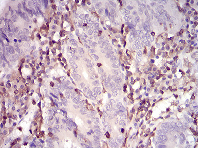 WASP Antibody in Immunohistochemistry (Paraffin) (IHC (P))