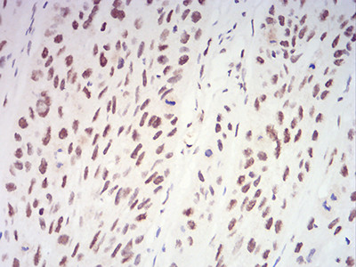 XRN2 Antibody in Immunohistochemistry (Paraffin) (IHC (P))