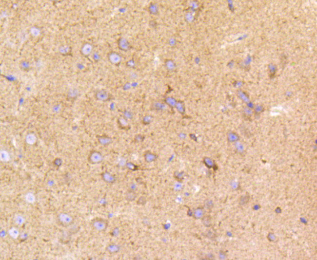 LRP1 Antibody in Immunohistochemistry (Paraffin) (IHC (P))