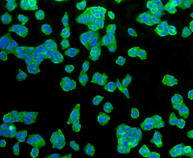 GLUT1 Antibody in Immunocytochemistry (ICC/IF)