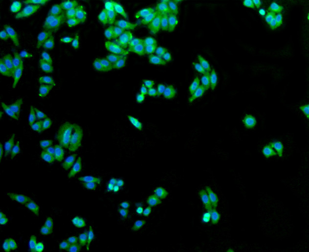 GLUT1 Antibody in Immunocytochemistry (ICC/IF)