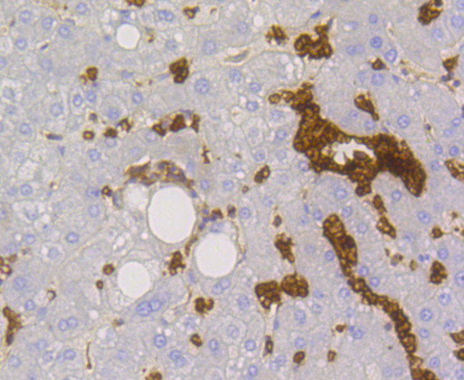 GLUT1 Antibody in Immunohistochemistry (Paraffin) (IHC (P))