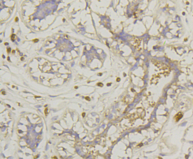 GLUT1 Antibody in Immunohistochemistry (Paraffin) (IHC (P))