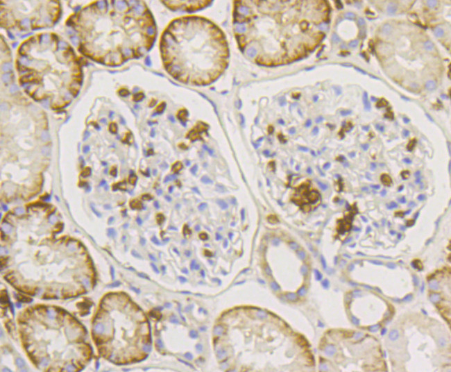 GLUT1 Antibody in Immunohistochemistry (Paraffin) (IHC (P))