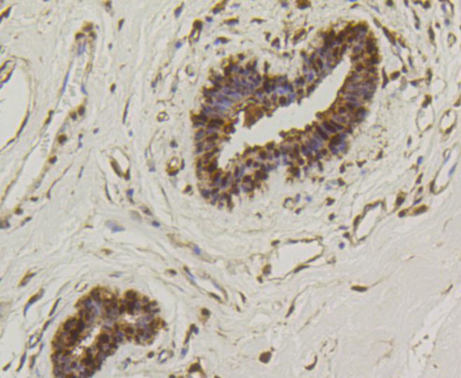 HSP70 Antibody in Immunohistochemistry (Paraffin) (IHC (P))