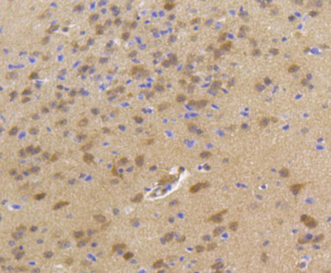 HSP70 Antibody in Immunohistochemistry (Paraffin) (IHC (P))