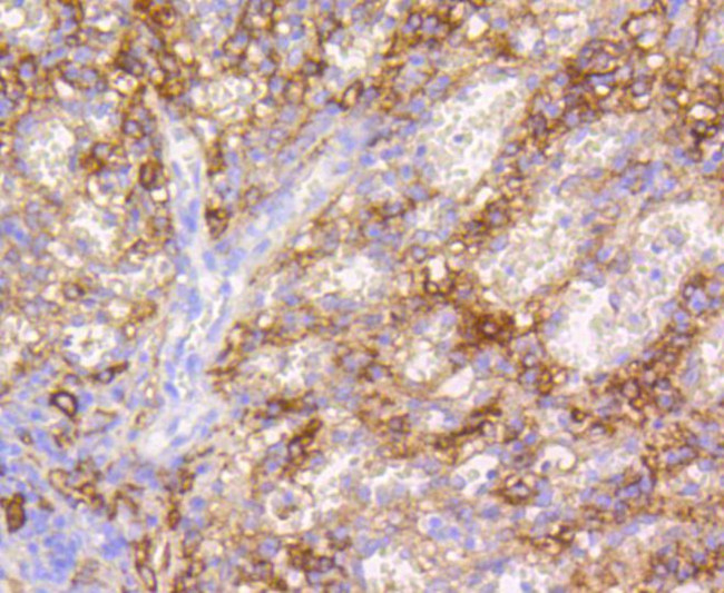 VCAM-1 (CD106) Antibody in Immunohistochemistry (Paraffin) (IHC (P))