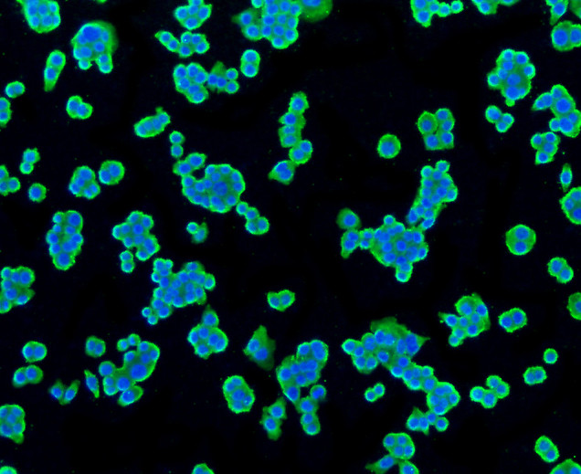 TSPO Antibody in Immunocytochemistry (ICC/IF)