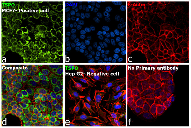 TSPO Antibody