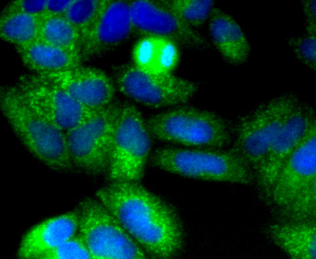 CD271 (NGF Receptor) Antibody in Immunocytochemistry (ICC/IF)