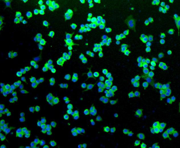 CD271 (NGF Receptor) Antibody in Immunocytochemistry (ICC/IF)