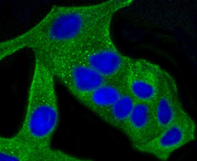 ALAS1 Antibody in Immunocytochemistry (ICC/IF)