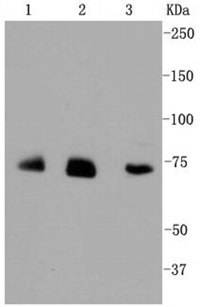 ALAS1 Antibody in Western Blot (WB)