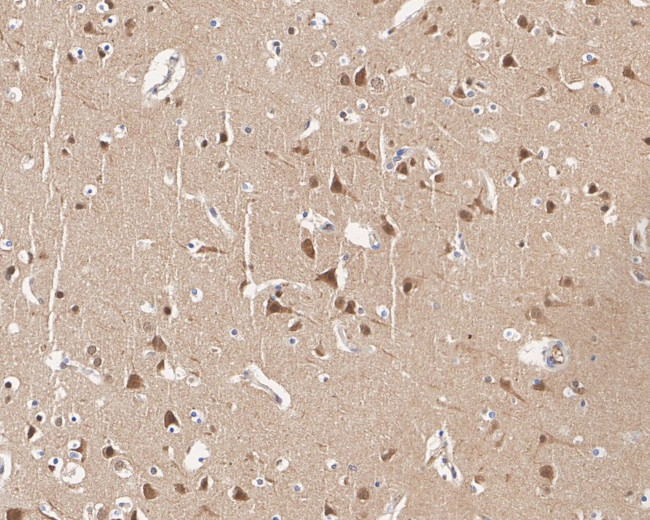 JNK1/JNK2/JNK3 Antibody in Immunohistochemistry (Paraffin) (IHC (P))