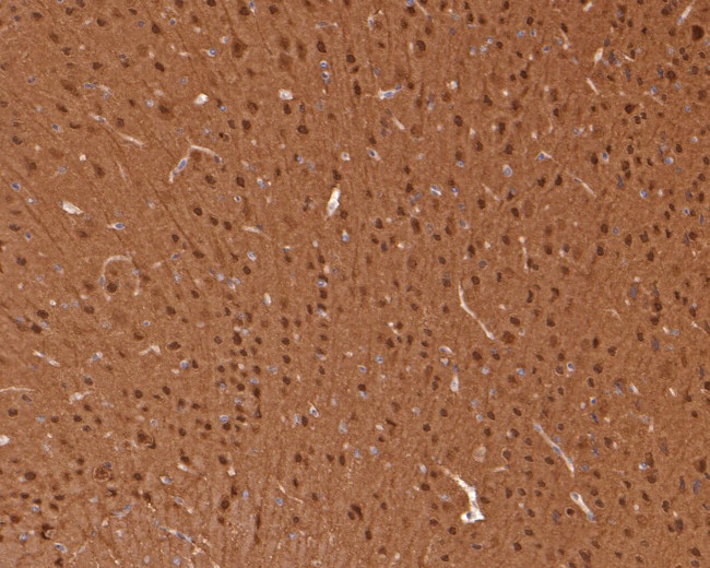 JNK1/JNK2/JNK3 Antibody in Immunohistochemistry (Paraffin) (IHC (P))