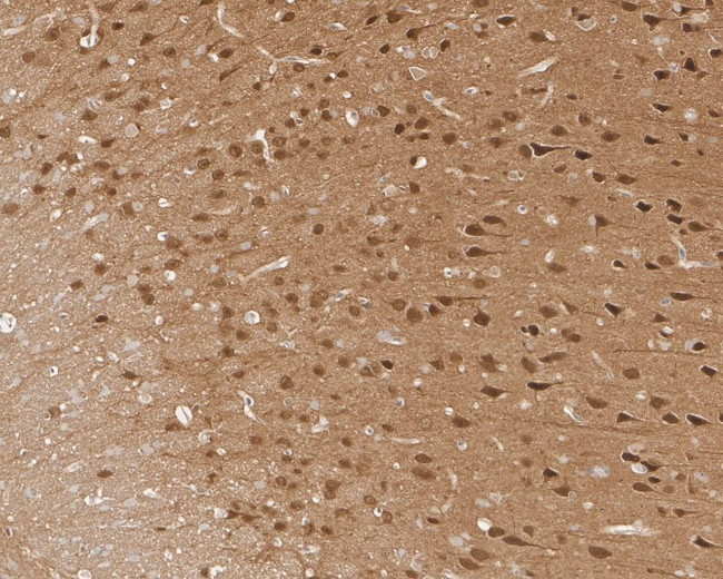 JNK1/JNK2/JNK3 Antibody in Immunohistochemistry (Paraffin) (IHC (P))