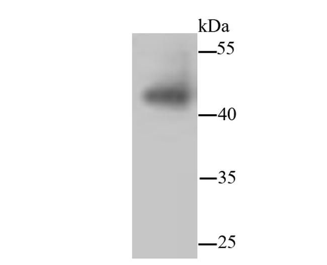 JNK1/JNK2/JNK3 Antibody in Western Blot (WB)