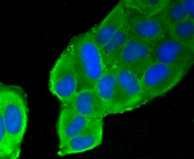 Filamin A Antibody in Immunocytochemistry (ICC/IF)