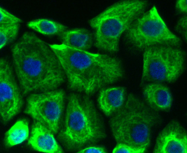 Cytokeratin 19 Antibody in Immunocytochemistry (ICC/IF)