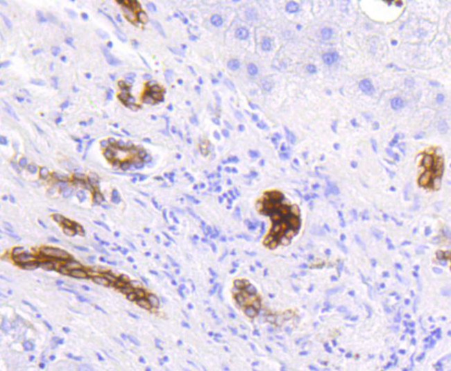 Cytokeratin 19 Antibody in Immunohistochemistry (Paraffin) (IHC (P))