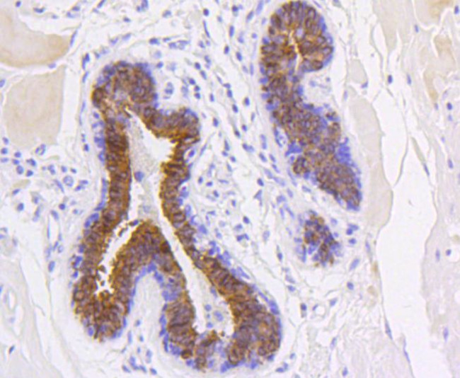 Cytokeratin 19 Antibody in Immunohistochemistry (Paraffin) (IHC (P))