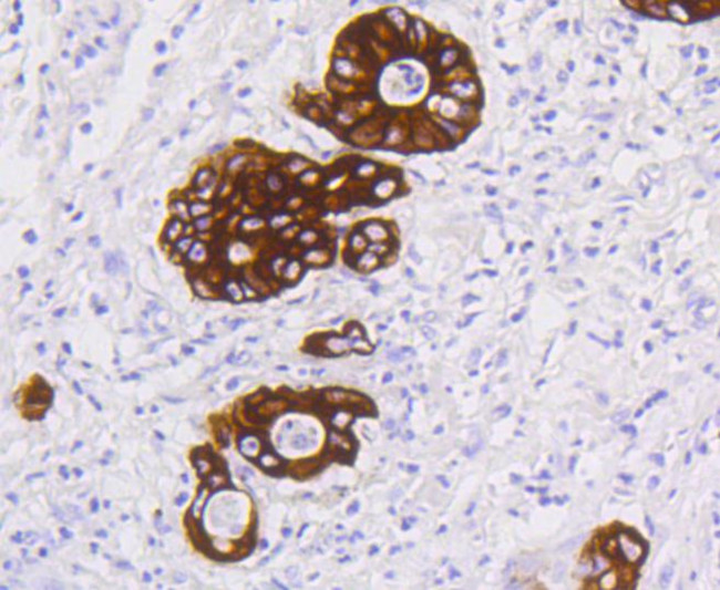 Cytokeratin 19 Antibody in Immunohistochemistry (Paraffin) (IHC (P))