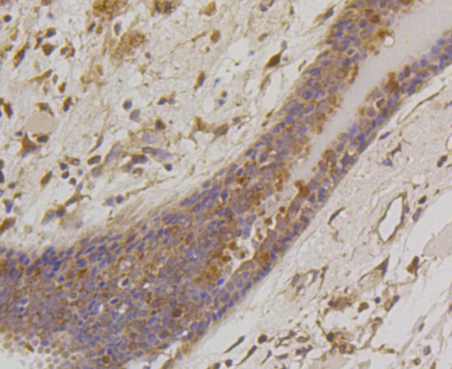 BAD Antibody in Immunohistochemistry (Paraffin) (IHC (P))