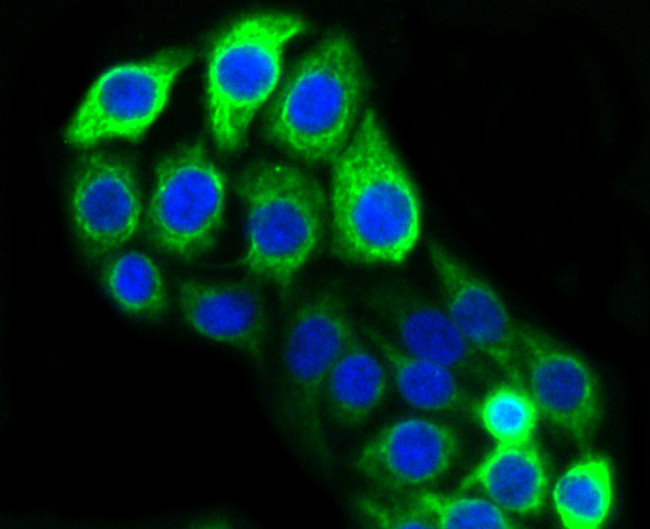 Cytokeratin 20 Antibody in Immunocytochemistry (ICC/IF)