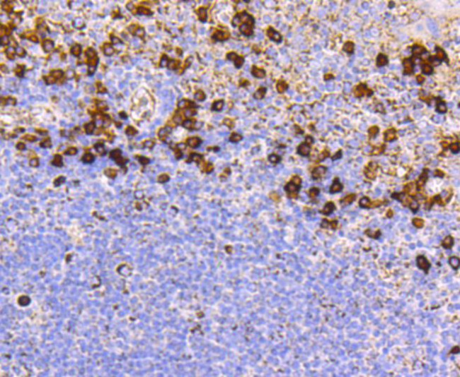 CD9 Antibody in Immunohistochemistry (Paraffin) (IHC (P))