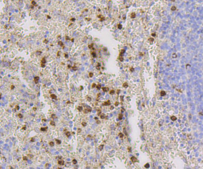 CD9 Antibody in Immunohistochemistry (Paraffin) (IHC (P))