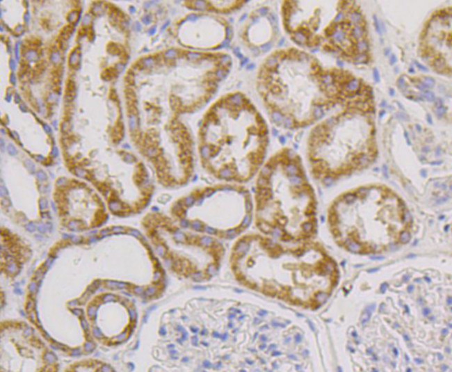 CD9 Antibody in Immunohistochemistry (Paraffin) (IHC (P))