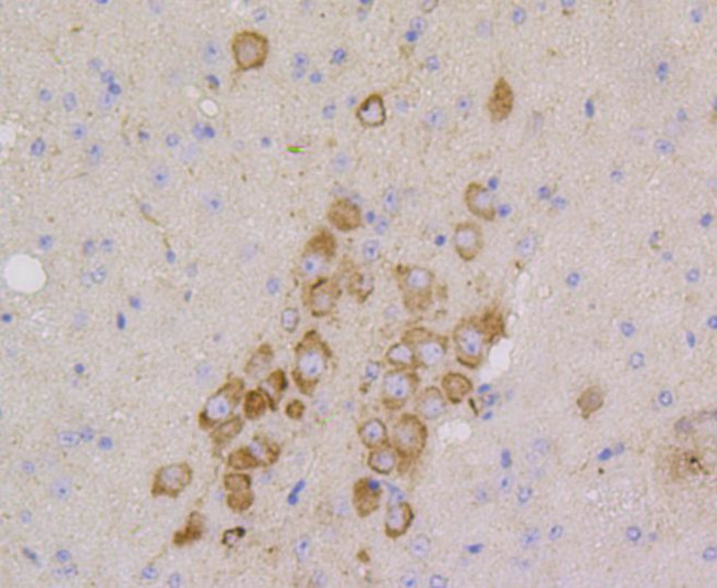 CD9 Antibody in Immunohistochemistry (Paraffin) (IHC (P))