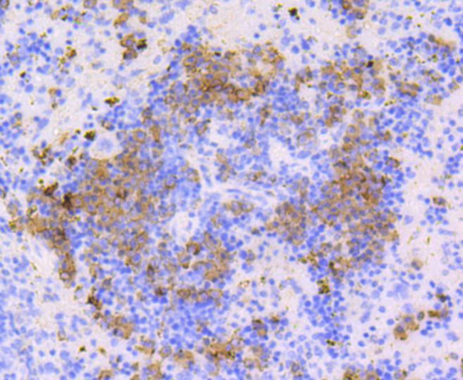 CD9 Antibody in Immunohistochemistry (Paraffin) (IHC (P))