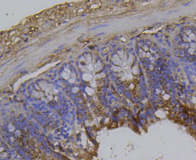 Integrin beta 1 (CD29) Antibody in Immunohistochemistry (Paraffin) (IHC (P))