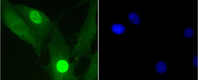 Phospho-Histone H1.3/H1.4 (Thr17) Antibody in Immunocytochemistry (ICC/IF)