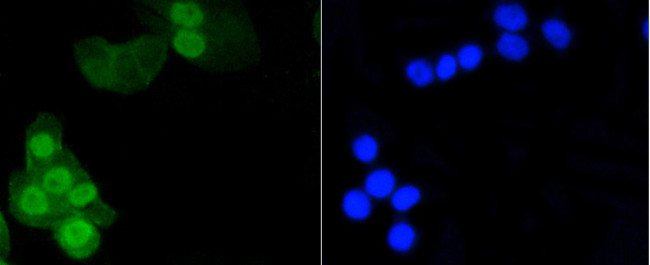 Phospho-Histone H1.3/H1.4 (Thr17) Antibody in Immunocytochemistry (ICC/IF)