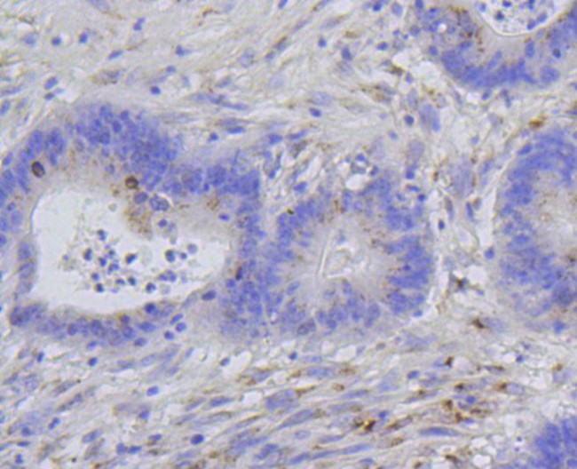 Phospho-Histone H1.3/H1.4 (Thr17) Antibody in Immunohistochemistry (Paraffin) (IHC (P))