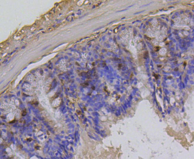 Phospho-Histone H1.3/H1.4 (Thr17) Antibody in Immunohistochemistry (Paraffin) (IHC (P))