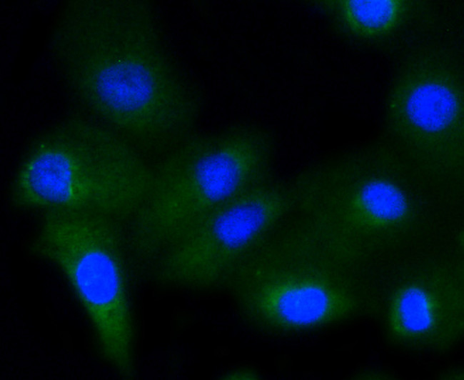 Phospho-GYS1 (Ser641) Antibody in Immunocytochemistry (ICC/IF)