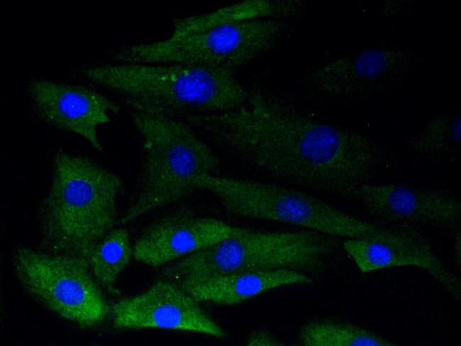 Phospho-GYS1 (Ser641) Antibody in Immunocytochemistry (ICC/IF)