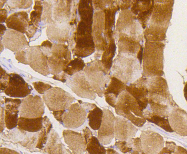 Phospho-GYS1 (Ser641) Antibody in Immunohistochemistry (Paraffin) (IHC (P))