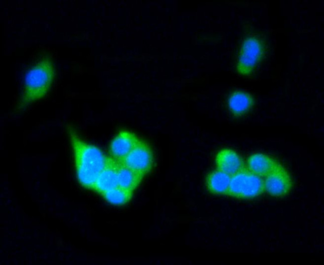 Rab4 Antibody in Immunocytochemistry (ICC/IF)